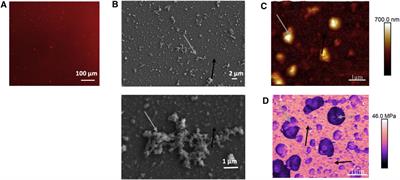 Poly-L-Lysine and Human Plasmatic Fibronectin Films as Proactive Coatings to Improve Implant Biointegration